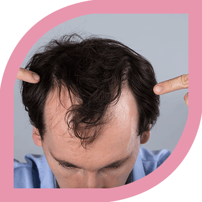Best PRP Treatment for Hairloss