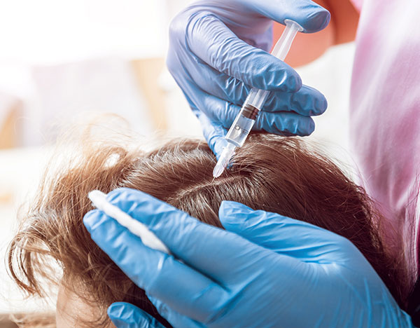Best PRP Hair and Hair Regrowth Treatments in Bangalore