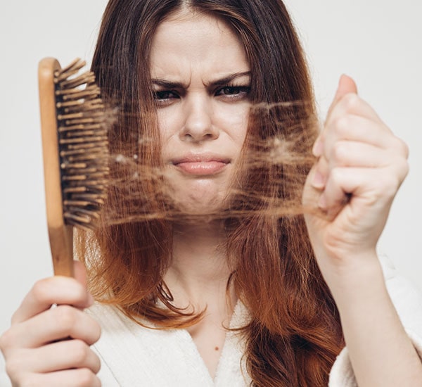 Female pattern baldness treatment Marathahalli Bangalore